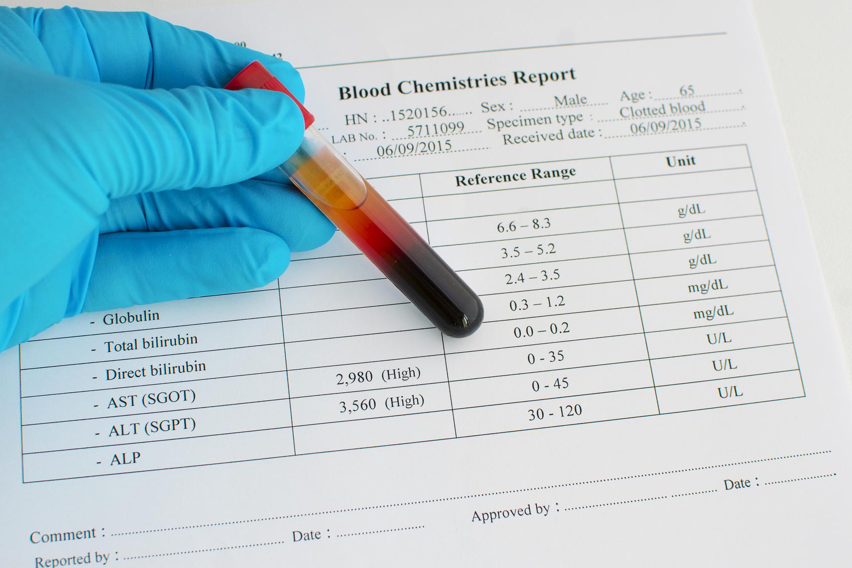аналіз крові розшифровка