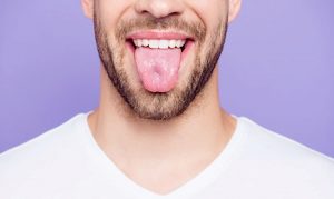 білий наліт на язику лікування