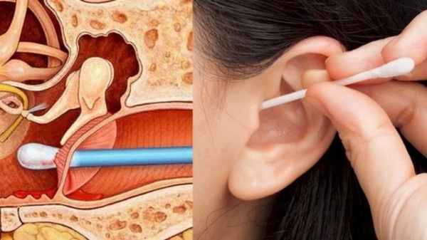 запалення середнього вуха лікування