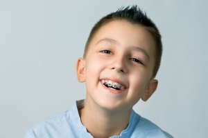 Як вирівняти зуби дитині брекетами