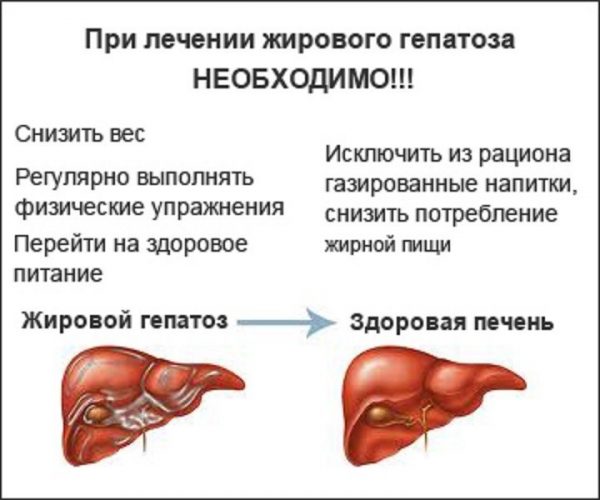 Причини жирового гепатозу