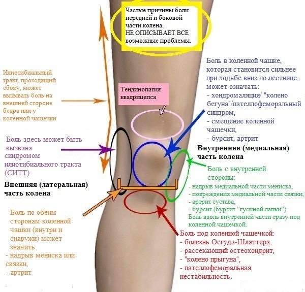 Як зміцнити колінний суглоб