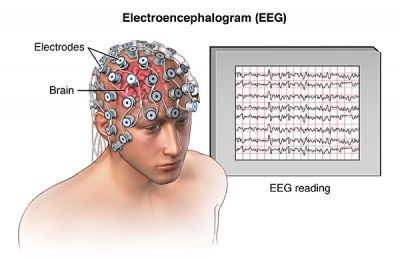 електроенцефалографія