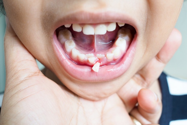 в скільки років випадають молочні зуби